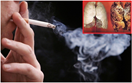 Hút thuốc lá- nguyên nhân gây ra những bệnh nguy hiểm