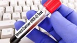 Thuốc giredestrant của Roche được FDA ưu tiên xem xét điều trị ung thư vú