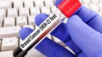 Thuốc giredestrant của Roche được FDA ưu tiên xem xét điều trị ung thư vú