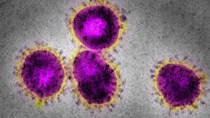 Cập nhật thông tin về virus corona ngày 23/2 và công tác phòng, chống dịch của Bộ CT