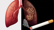 Ảnh hưởng của việc sử dụng thuốc lá đối với sức khỏe