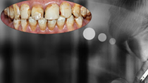 Nói “KHÔNG” với thuốc lá để bảo vệ răng miệng của bạn và những người xung quanh!