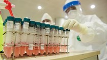 Bộ Y tế nhập 200.000 test xét nghiệm nhanh nCoV