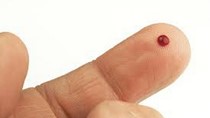 Phát triển dụng cụ phát hiện nhanh ung thư chỉ bằng mẫu máu