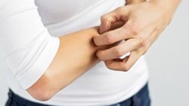 Năm loại thực phẩm có tác dụng dưỡng da, trị ngứa trong mùa Đông