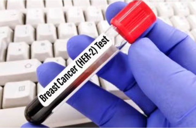 Thuốc giredestrant của Roche được FDA ưu tiên xem xét điều trị ung thư vú