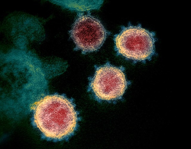 Cập nhật thông tin về virus corona ngày 19/2 và công tác phòng, chống dịch của Bộ CT